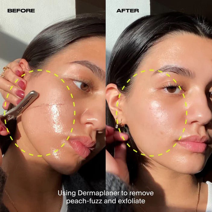 Leaf Dermaplaner before and after results – removing peach fuzz and exfoliating for smoother, glowing skin